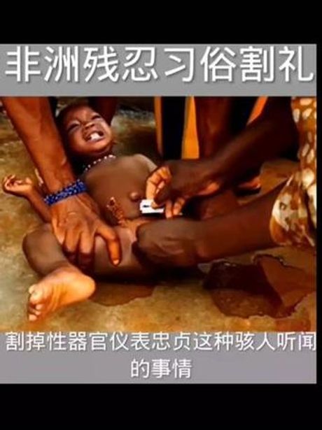 女孩割礼：亚洲的古老风俗还在延续吗？